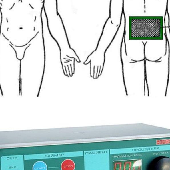 Точки электрофореза