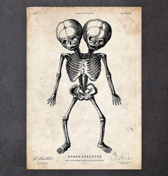 Скелет плакат