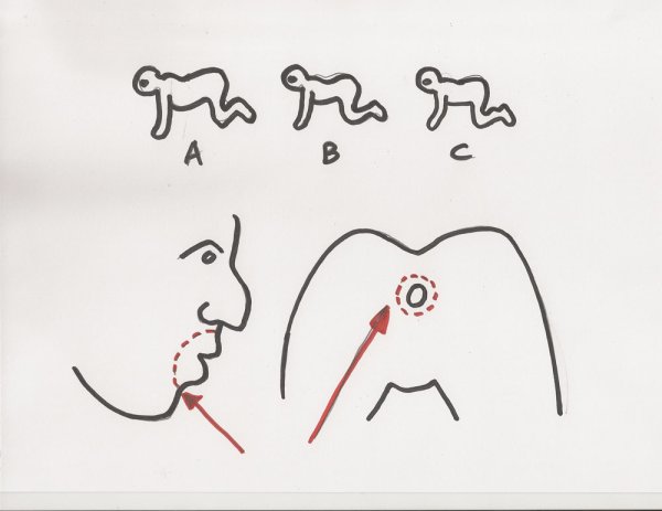 Дитер лазер человеческая многоножка 3