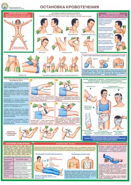 Плакат техника реанимации электротравмы остановка кровотечения