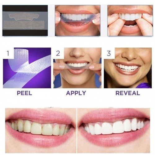 Полоски для отбеливания зубов