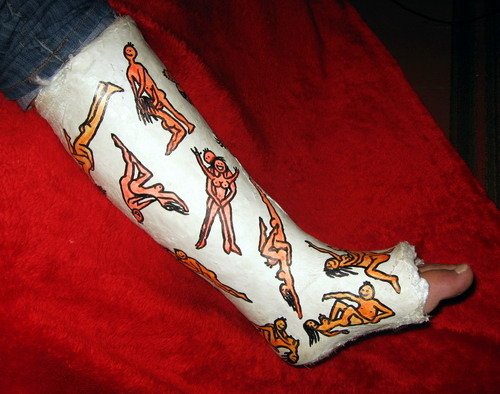 Разрисованный гипс