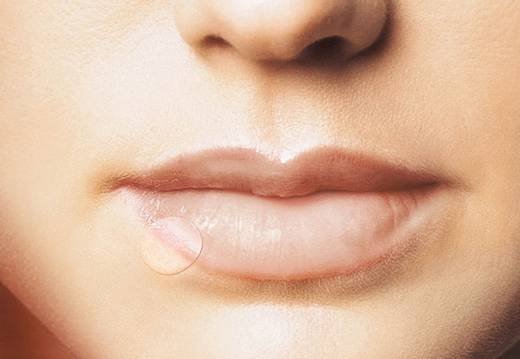 Compeed герпес