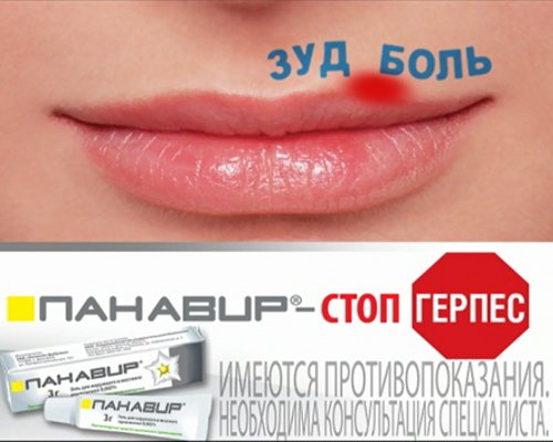 Мазь от заедов в уголках губ для ребенка