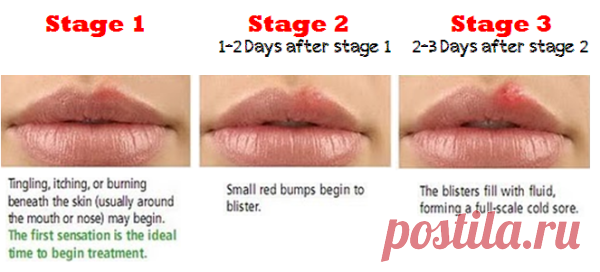 Средство от простуды на губах