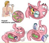 Санбюллетень гастрит