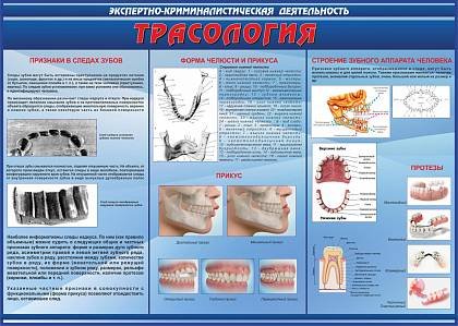 Система криминалистическая габитоскопия;