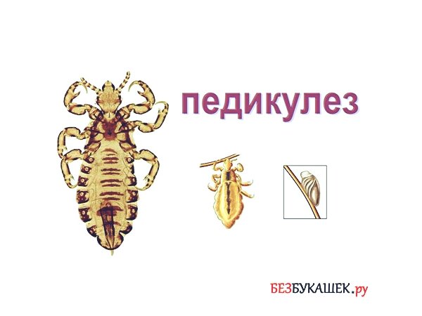 Вши плакат для дошкольников