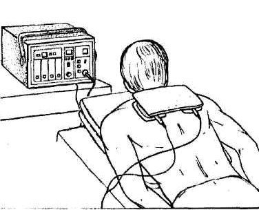 Флюктуоризация механизм действия