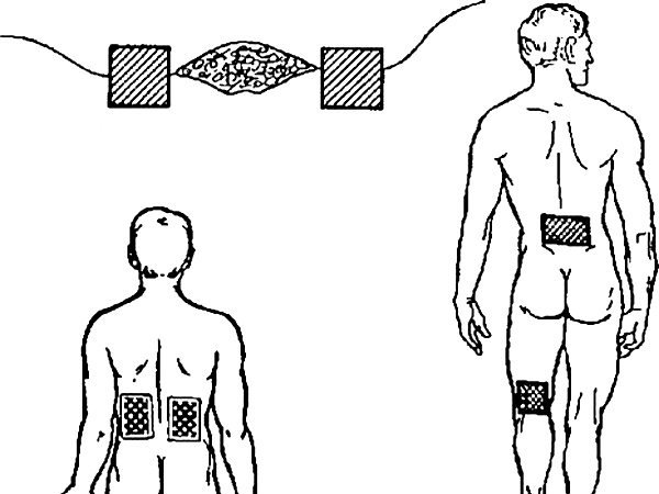Физиотерапия презентация
