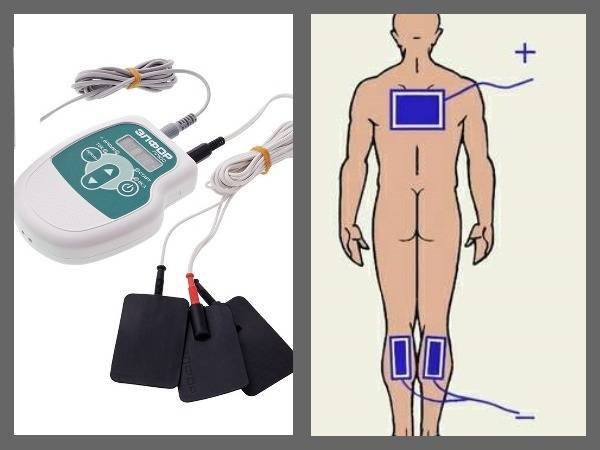 Электрофорез схемы наложения электродов