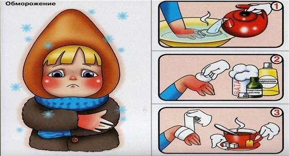 Первая помощь при обморожении картинки