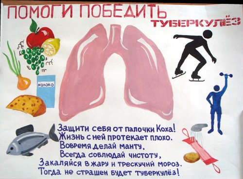 Победим туберкулез вместе