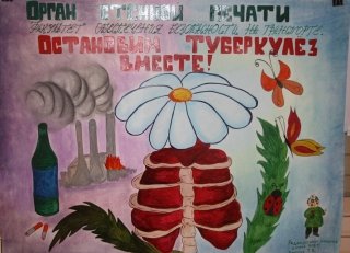 Туберкулез Сан билютень