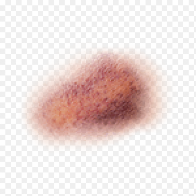 Кровоподтеки на прозрачном фоне