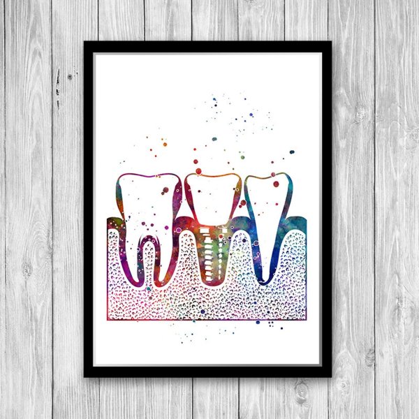 Зуб абстракция