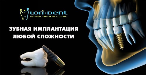 Живопись зубов