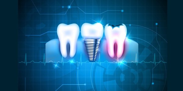 Красивая улыбка креативная картинка