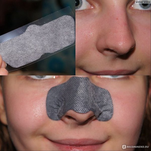 Наклейки от чёрных точек