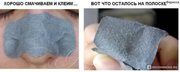 Полоски для носа от черных точек