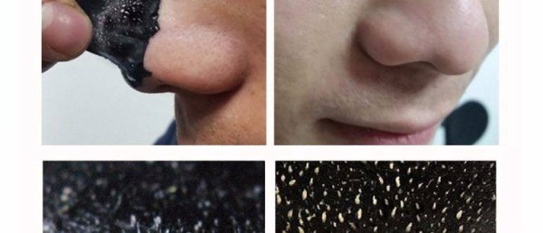 Полоски от черных точек