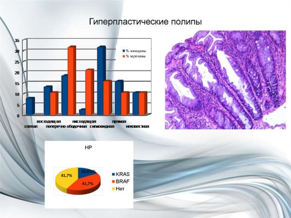 Охраняется сигнализация