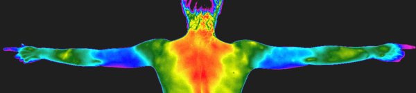 Персистирующая гиалоидная артерия