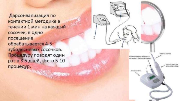 Железистая гиперплазия эндометрия УЗИ