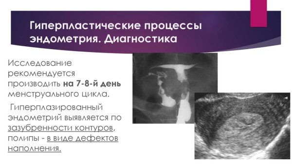 Полипэктомия шейки матки алгоритм