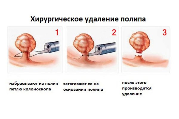 Гистология фундального отдела желудка