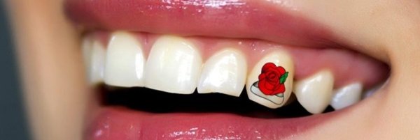 Наклейки стоматологические на стену