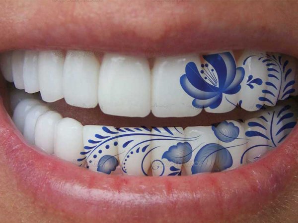 Наклейки стоматологические