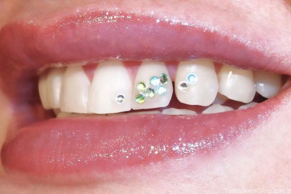 Украшения для зубов скайсы