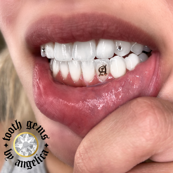 Наклейки на зубы