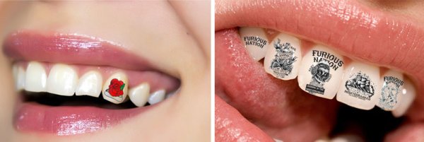 Украшения для зубов скайсы