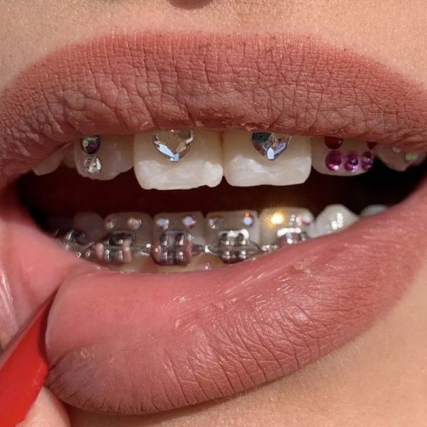 Наклейки на зубы скайсы