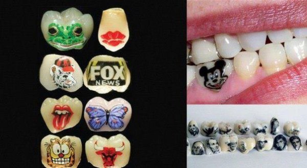 Наклейки на зубы скайсы