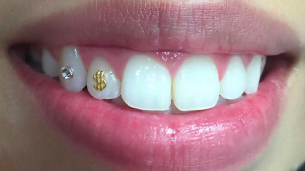 Зубные украшения скайсы