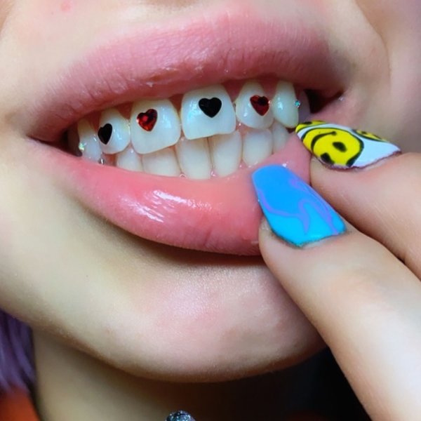 Скайсы для зубов