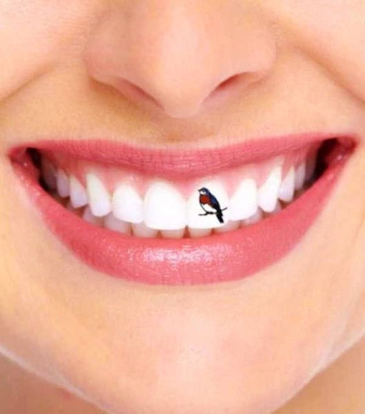 Твинклы и скайсы на зубы