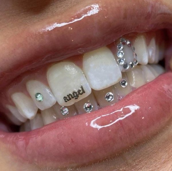 Украшения на зубы скайсы
