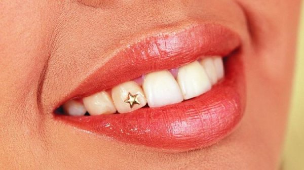 Набор для украшения зубов скайсами