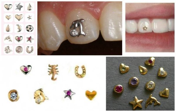 Наклейки на зубы