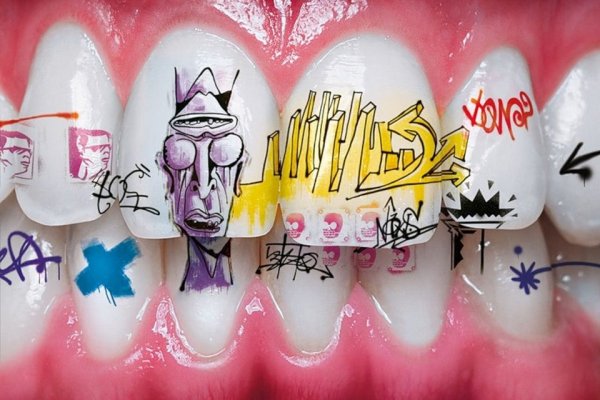 Украшения на зубы скайсы