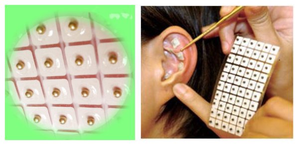 Кнопки Аурикулярные ушные иглы