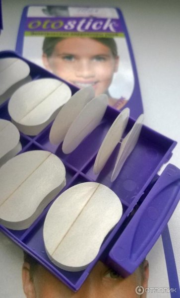 Иглы кнопки акупунктурные