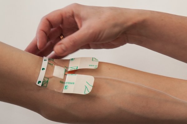 Стерильные повязки послеоперационные марлевые