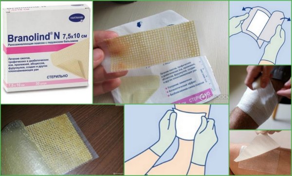 Мазевый пластырь Бранолинд