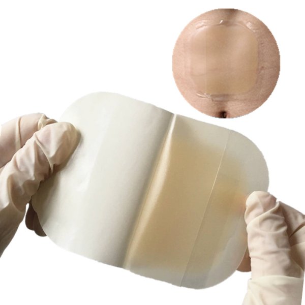 Гидроколлоидный пластырь для РАН