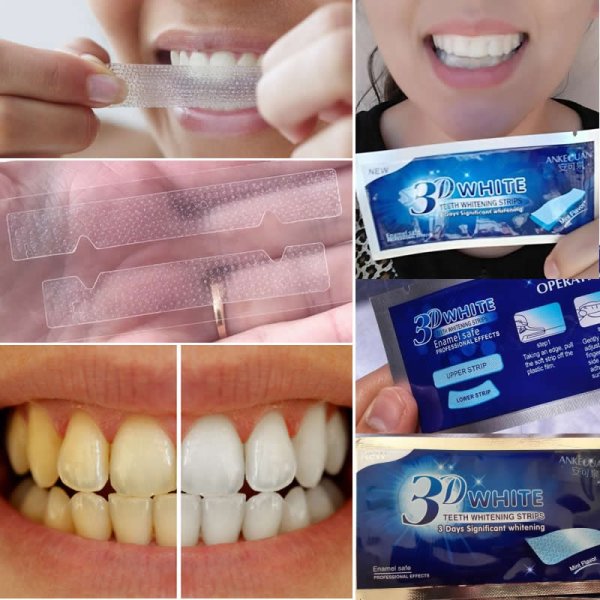 Отбеливающие системы для зубов профессиональная